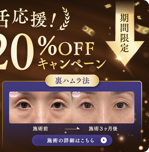 裏ハムラ法 キャンペーン