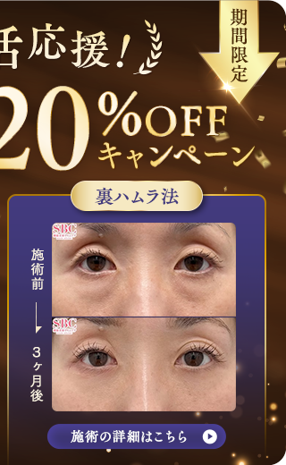 裏ハムラ法 キャンペーン