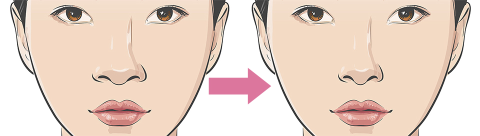 小鼻による表情の違い