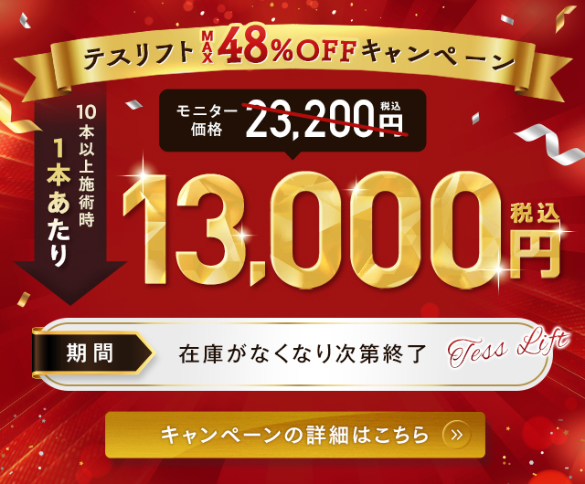25%OFF