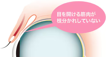 目を開ける筋肉が枝分かれしていない