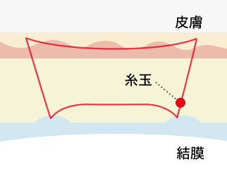 従来の縫い方