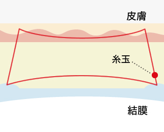 新しい縫い方