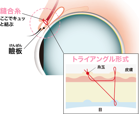 週末二重&reg;とは