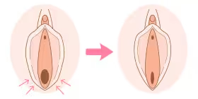 膣を引き締めたい イメージ