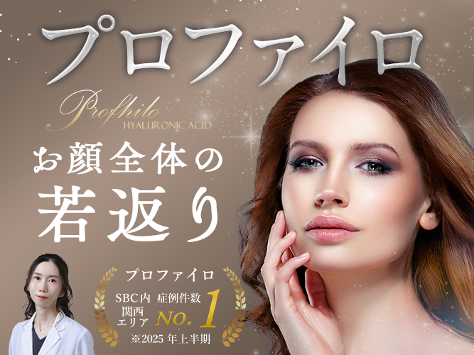 プロファイロ