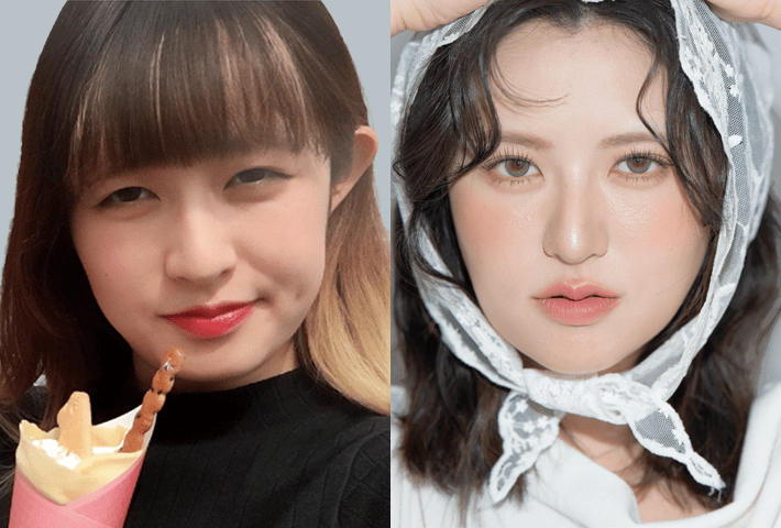 Before After 症例3