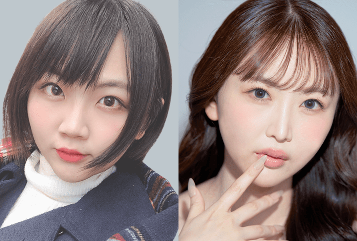 Before After 症例4