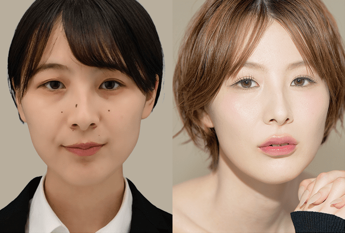 Before After 症例6