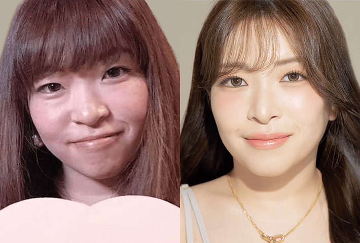 Before After 症例7