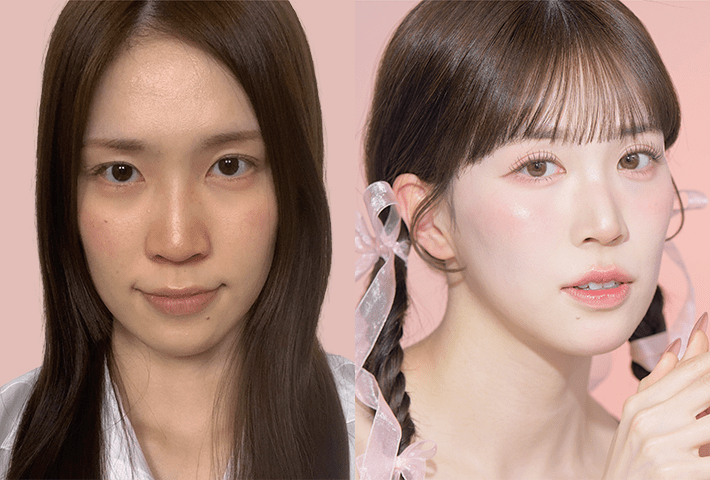 Before After 症例8