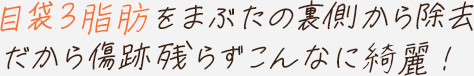 目袋3脂肪をまぶたの裏側から除去だから傷跡残らずこんなに綺麗！