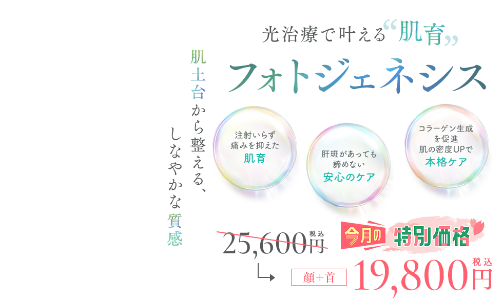 フォトジェネシス