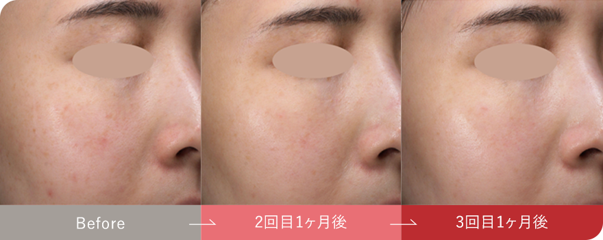 症例写真4