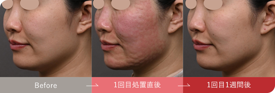 症例写真8
