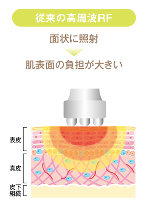 従来の高周波RF