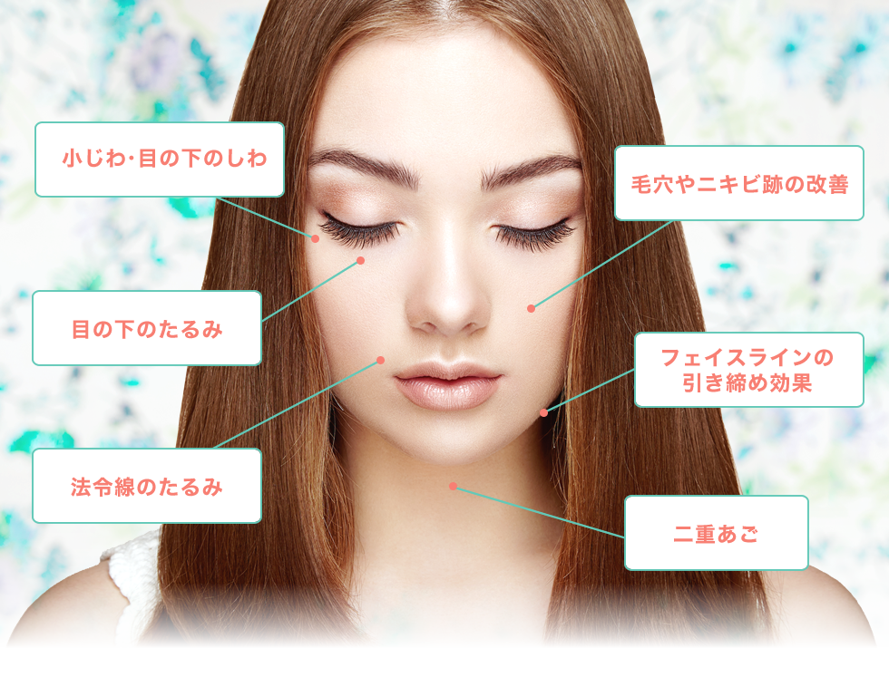 サーマタイトニングの効果