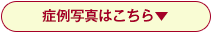 症例写真はこちら▼