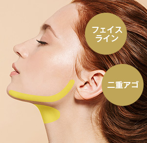 理想の小顔を実現する！新・脂肪溶解リニアハイフ