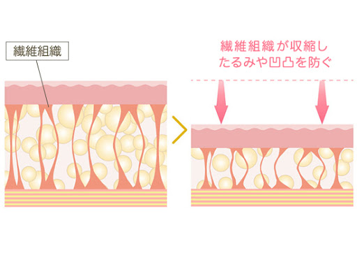 皮膚のタイトニング（引き締め）効果がある 画像03
