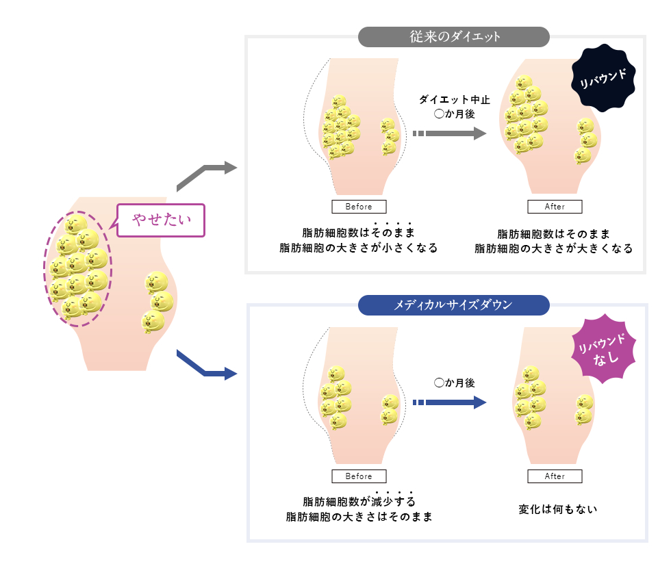 従来のダイエットとメディカルサイズダウンの違い