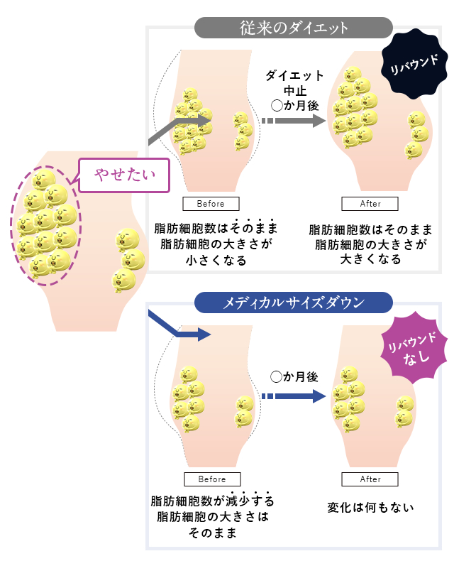 従来のダイエットとメディカルサイズダウンの違い