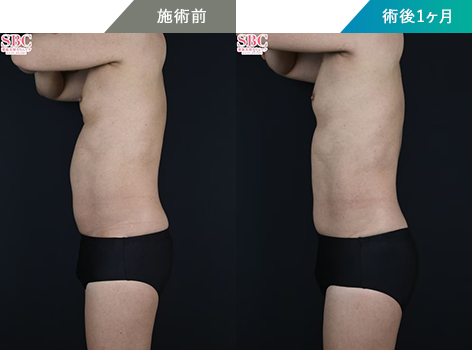 症例写真ボディ1