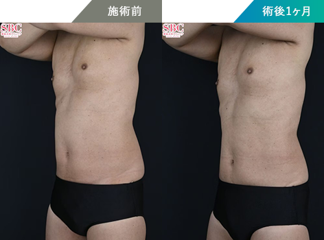 症例写真ボディ2