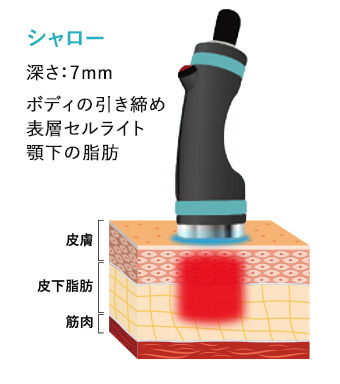 顔・体用ハンドピース イメージ2