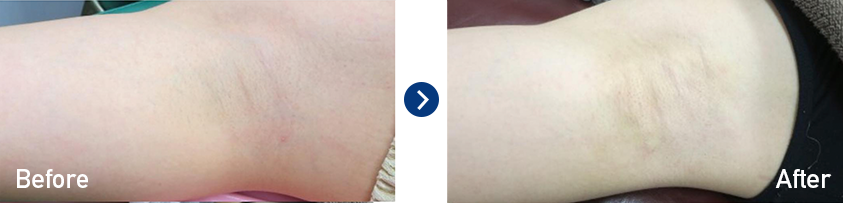 症例写真(Before&After)