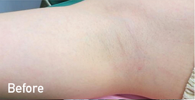 症例写真(Before)