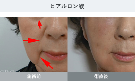 症例写真1