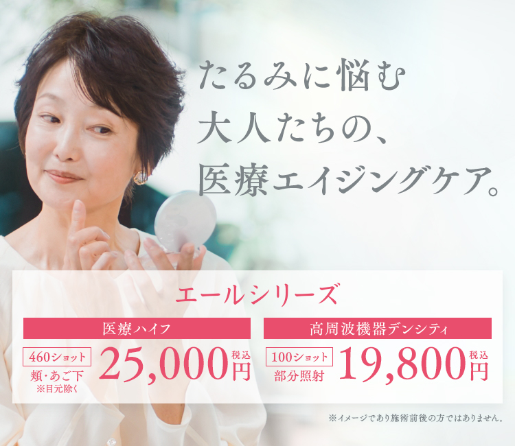 エールシリーズ
