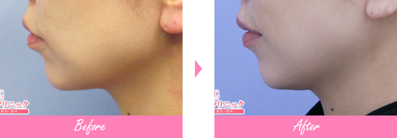 症例写真No.213656