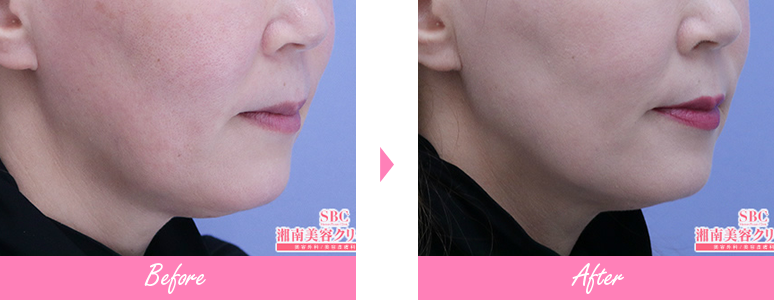 症例写真No.219344