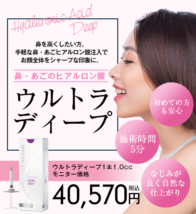 ウルトラディープ