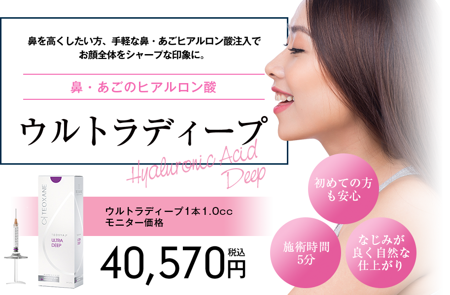 ウルトラディープ