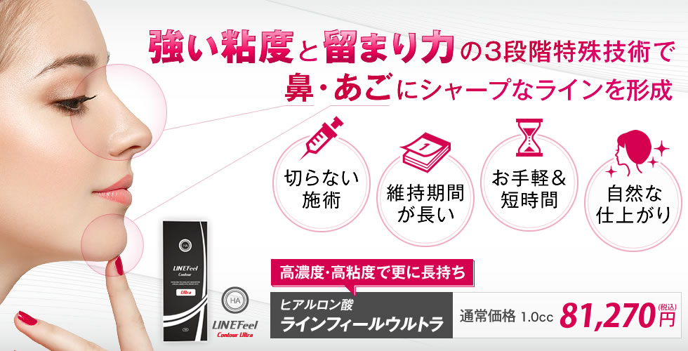 ラインフィールウルトラの詳細情報